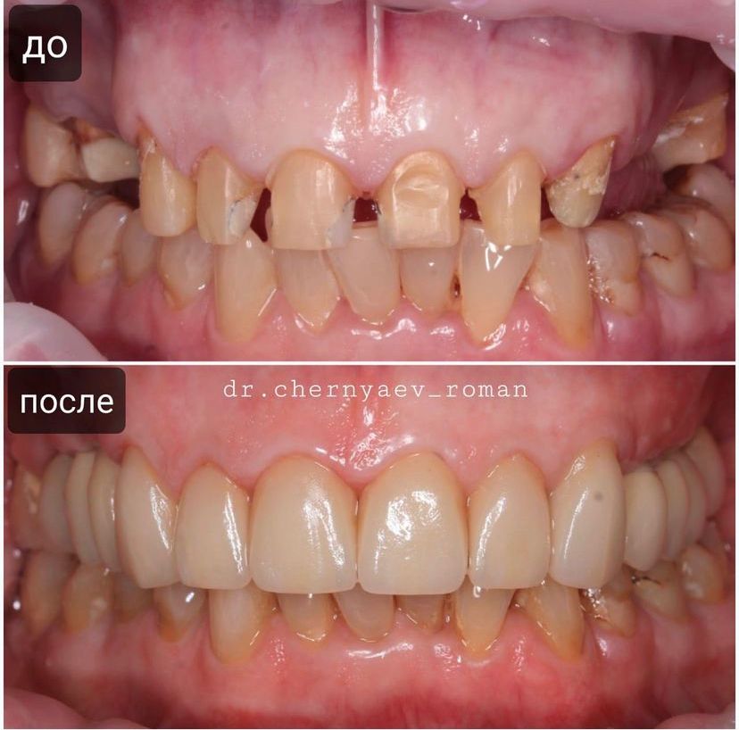 f48298acbcff99c3d07546f4bc7a5539.jpg f48298acbcff99c3d07546f4bc7a5539.jpg